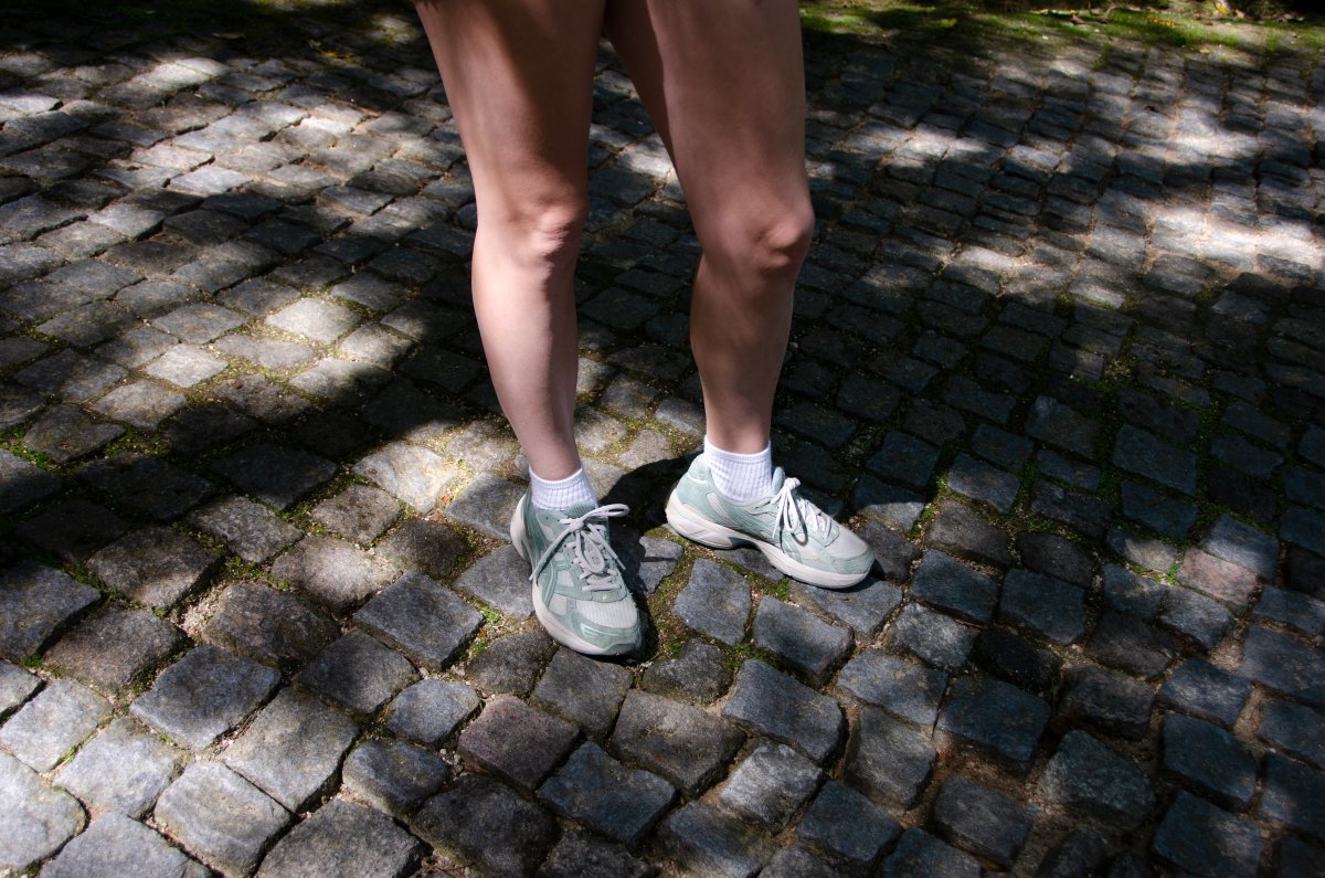 Legs